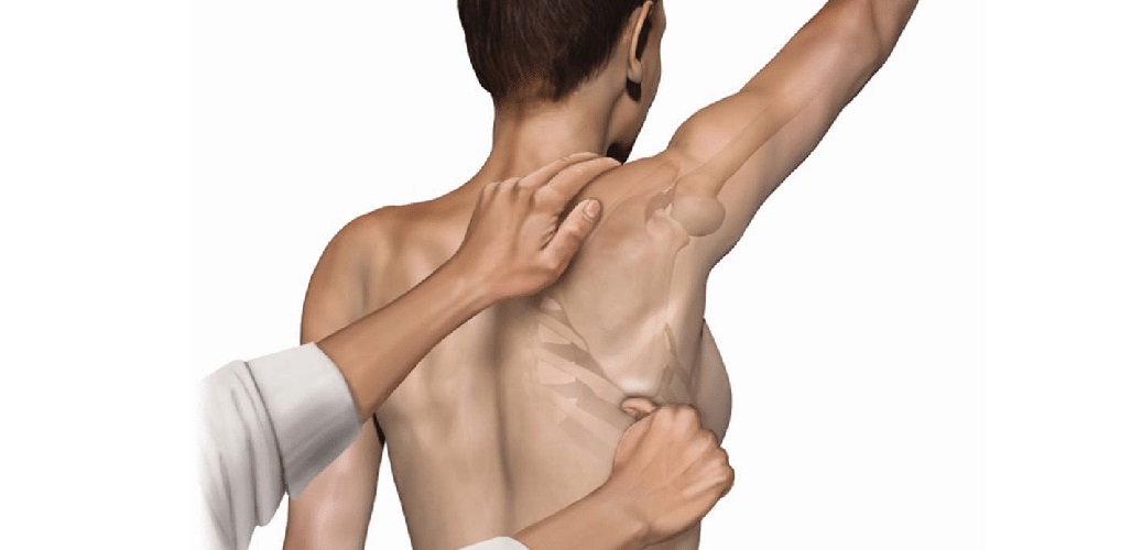 Test de asistencia escapular (Scapular Assistance Test) - Explicación ...